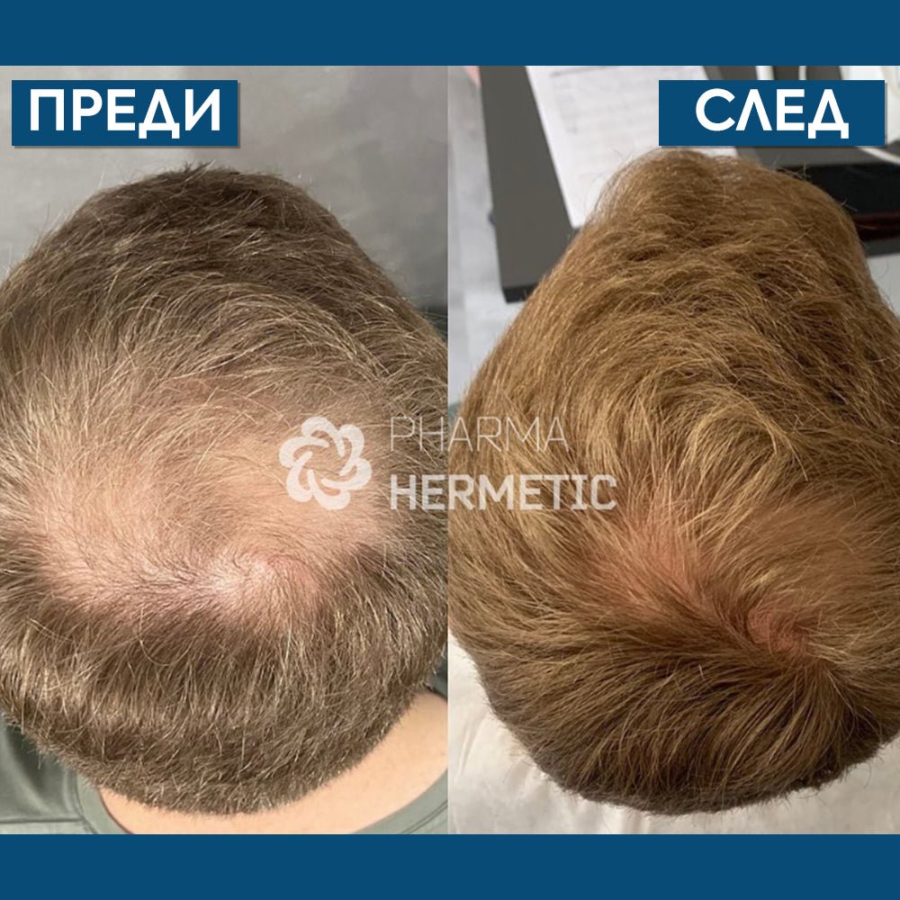 Лосион с пептиди против косопад и за стимулиране растежа на косата 50 мл - Pharma Hermetic