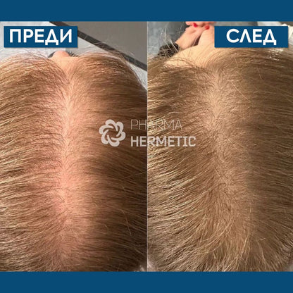 Лосион с пептиди против косопад и за стимулиране растежа на косата 50 мл - Pharma Hermetic